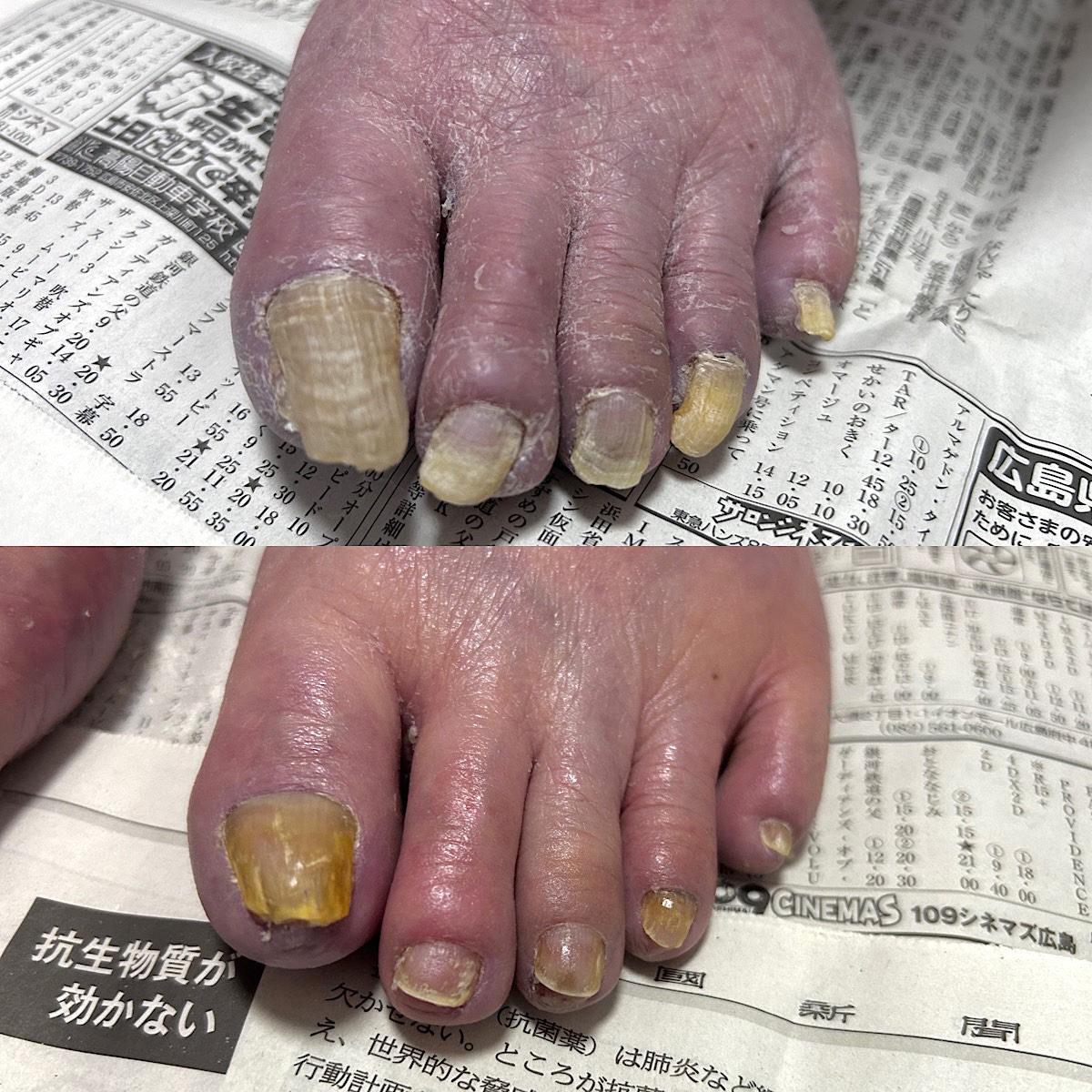 施術のビフォーアフター