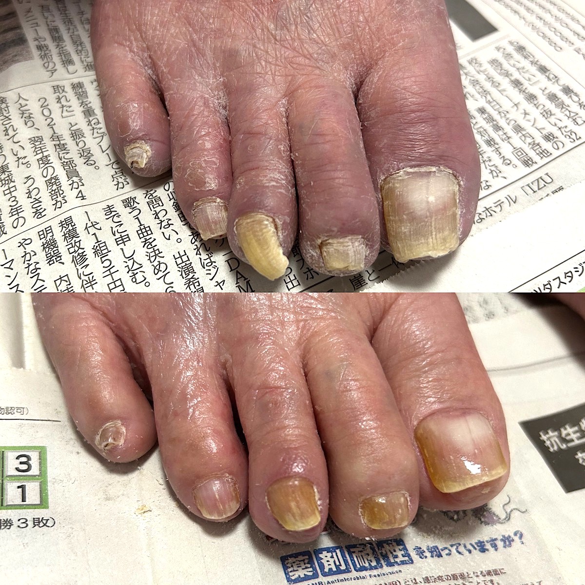 施術のビフォーアフター